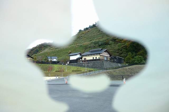 視野狭窄