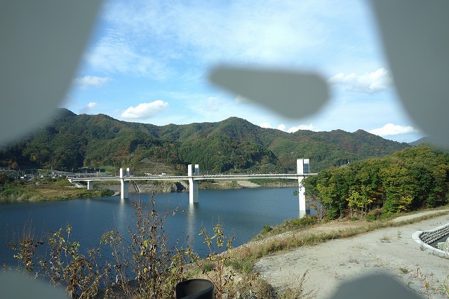 視野が欠ける